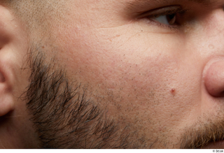  HD Face Skin Arthur Fuller cheek eye face skin pores skin texture wrinkles 0001.jpg